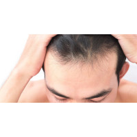 ΠΡΟΙΟΝΤΑ ΓΙΑ ΤΡΙΧΟΠΤΩΣΗ